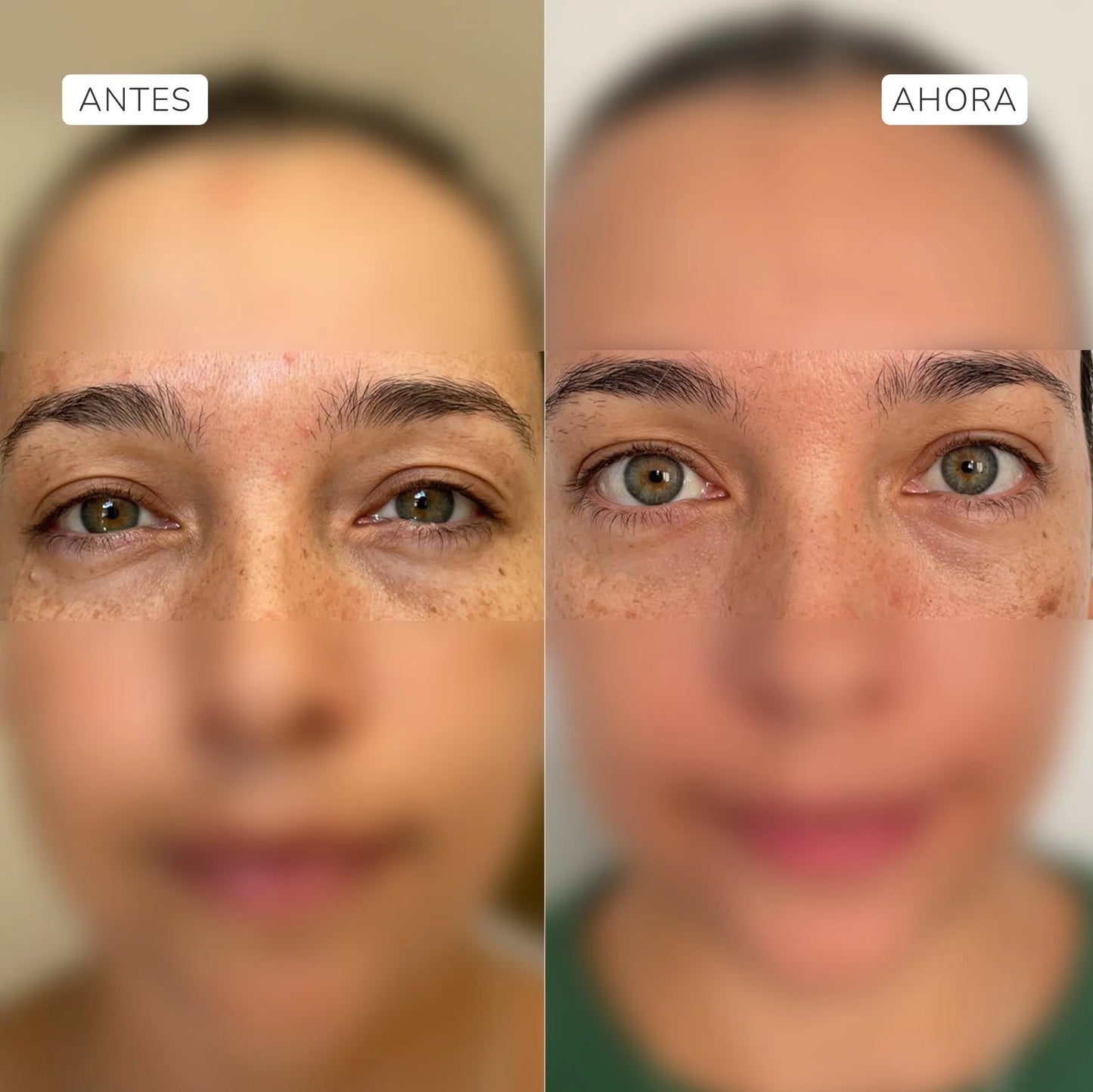 Complejo Antiedad Contorno de Ojos 18ML